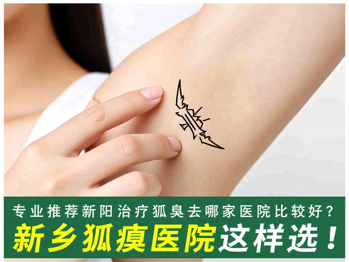 专业推荐新乡治疗狐臭去哪家医院比较好？新乡狐臭医院这样选！
