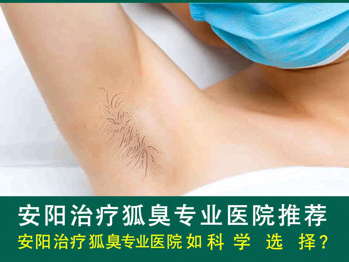 安阳治疗狐臭专业医院推荐，安阳治疗狐臭专业医院如何科学选择？