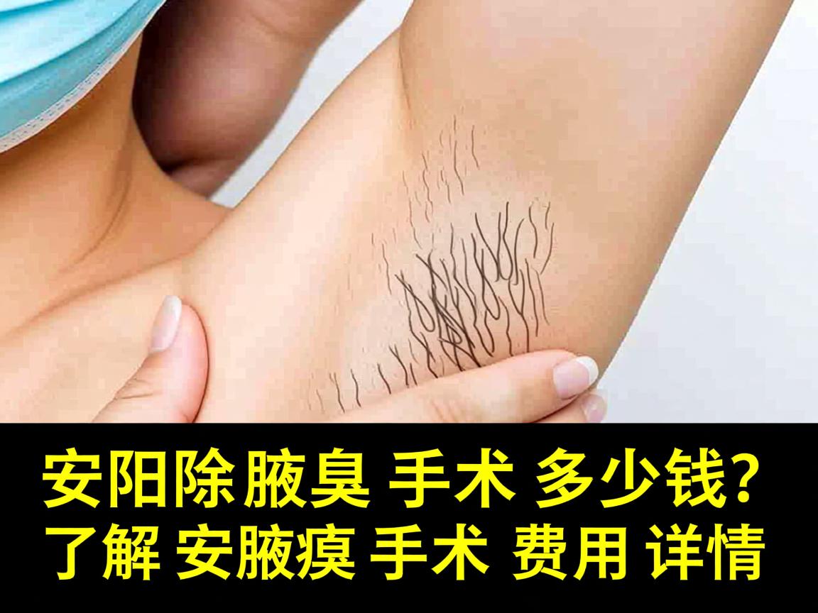 在安阳除腋臭手术多少钱？了解安阳腋臭手术费用详情