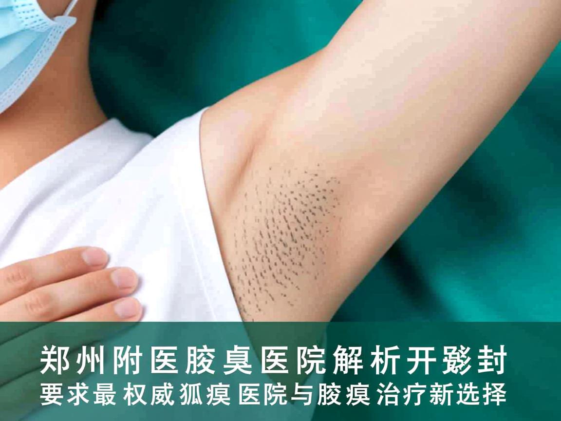 郑州附医腋臭医院解析,开封最权威狐臭医院与腋臭治疗新选择 郑州附医腋臭医院解析,开封最权威狐臭医院与腋臭治疗新选择