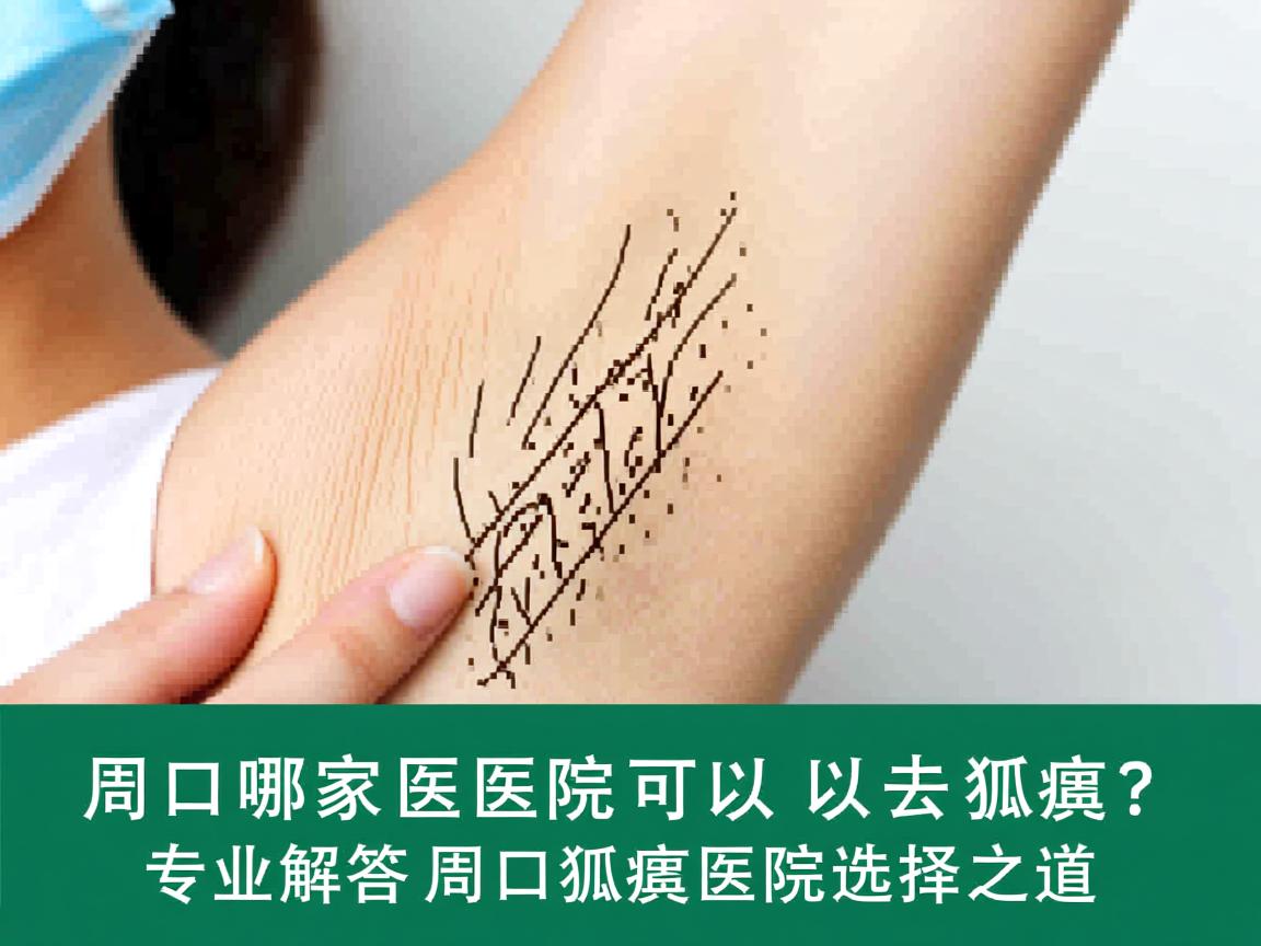 周口哪家医院可以去狐臭?专业解答周口狐臭医院选择之道 周口哪家医院可以去狐臭?专业解答周口狐臭医院选择之道
