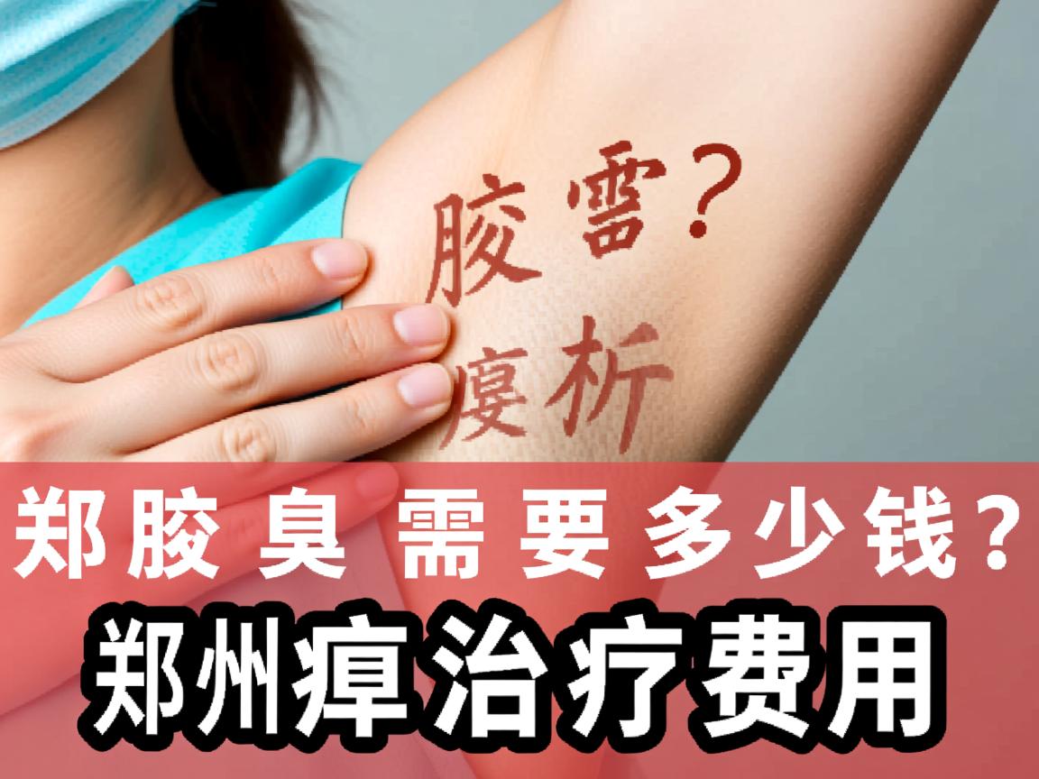 郑州治腋臭需要多少钱?深度解析郑州腋臭治疗费用 郑州治腋臭需要多少钱?深度解析郑州腋臭治疗费用