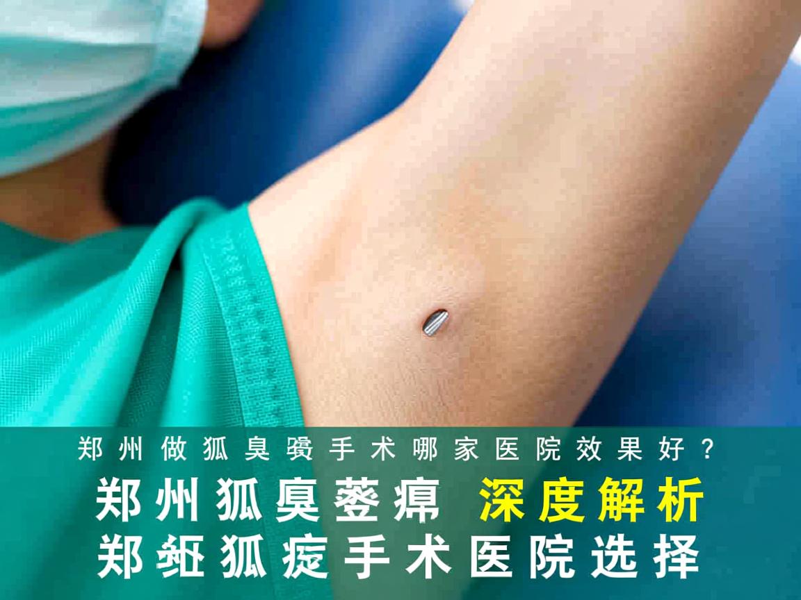 郑州做狐臭手术哪家医院效果好?深度解析郑州狐臭手术医院选择 郑州做狐臭手术哪家医院效果好?深度解析郑州狐臭手术医院选择
