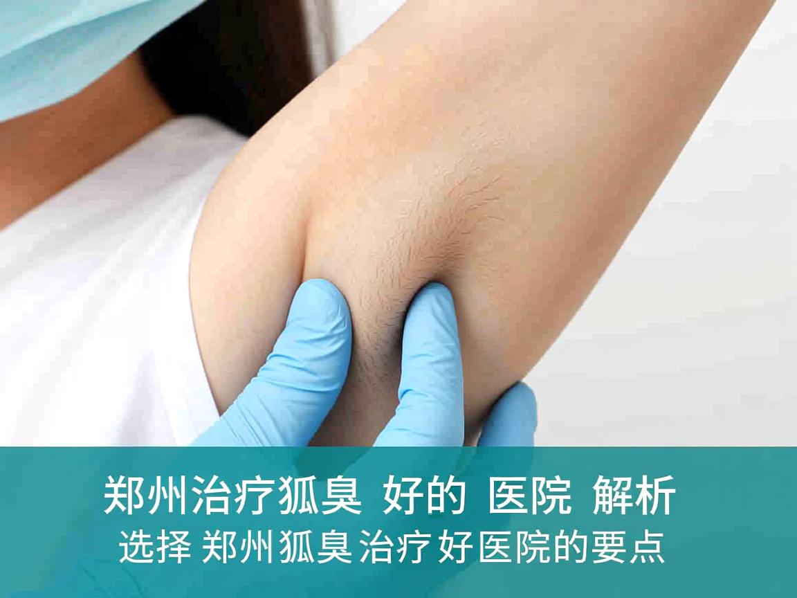 郑州治疗狐臭好的医院解析，选择郑州狐臭治疗好医院的要点
