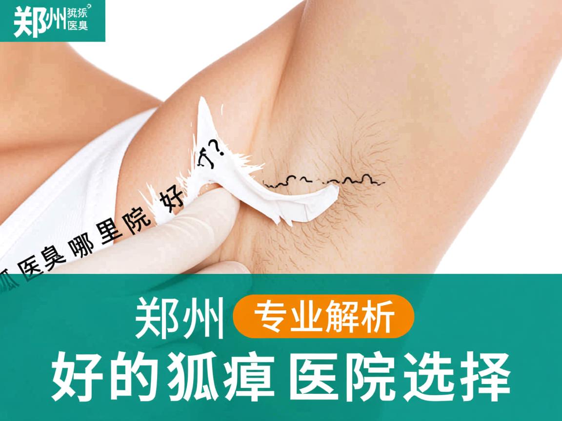 郑州狐臭医院哪里好?专业解析郑州好的狐臭医院选择 郑州狐臭医院哪里好?专业解析郑州好的狐臭医院选择