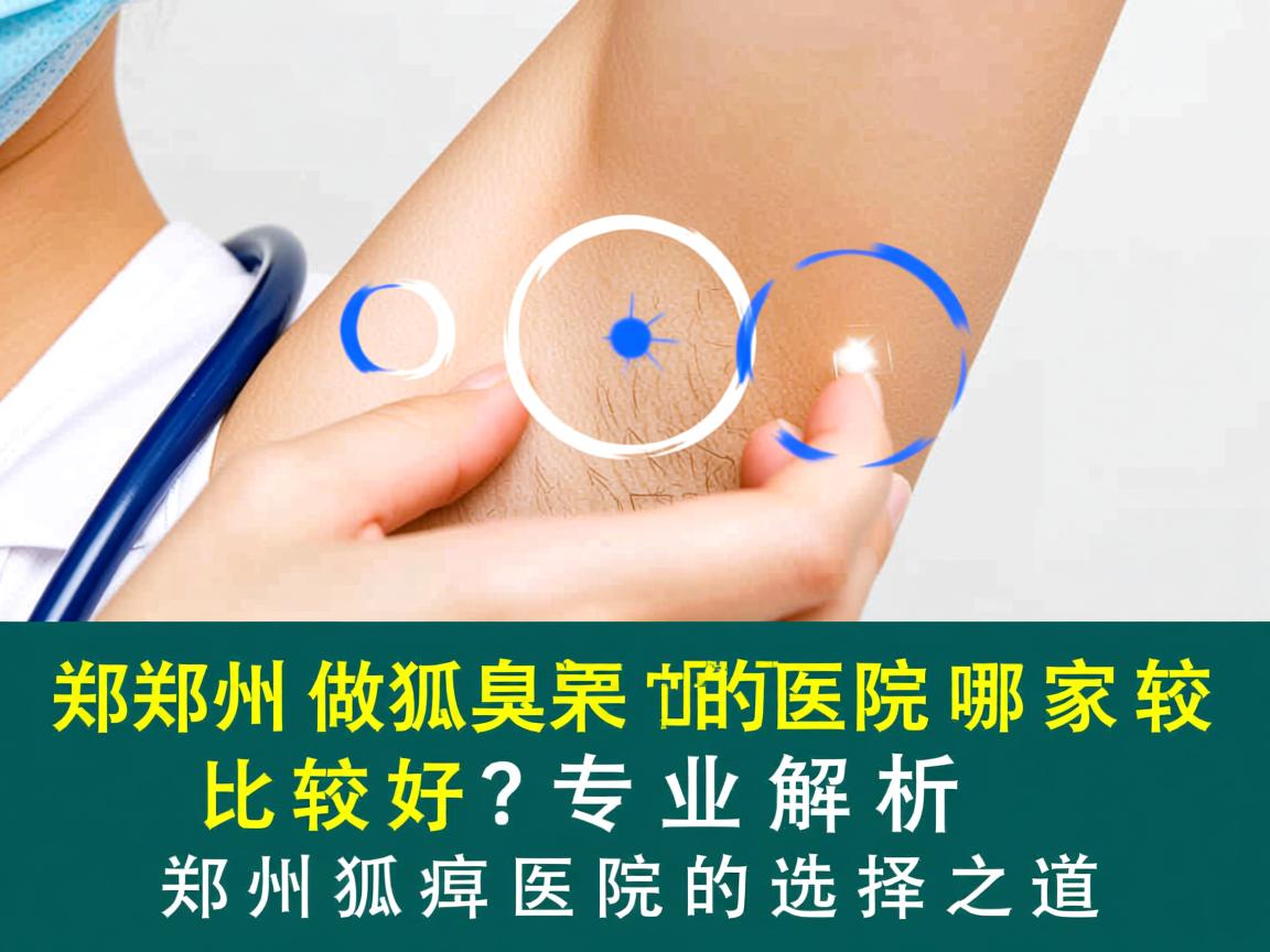 郑州做狐臭的医院哪家比较好?专业解析郑州狐臭医院的选择之道 郑州做狐臭的医院哪家比较好?专业解析郑州狐臭医院的选择之道