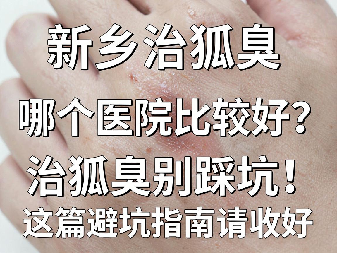 新乡治狐臭哪个医院比较好?治狐臭别踩坑,这篇避坑指南请收好 新乡治狐臭哪个医院比较好?治狐臭别踩坑,这篇避坑指南请收好