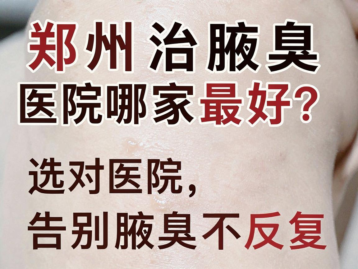 郑州治腋臭医院哪家最好?选对医院,告别腋臭不反复 郑州治腋臭医院哪家最好?选对医院,告别腋臭不反复