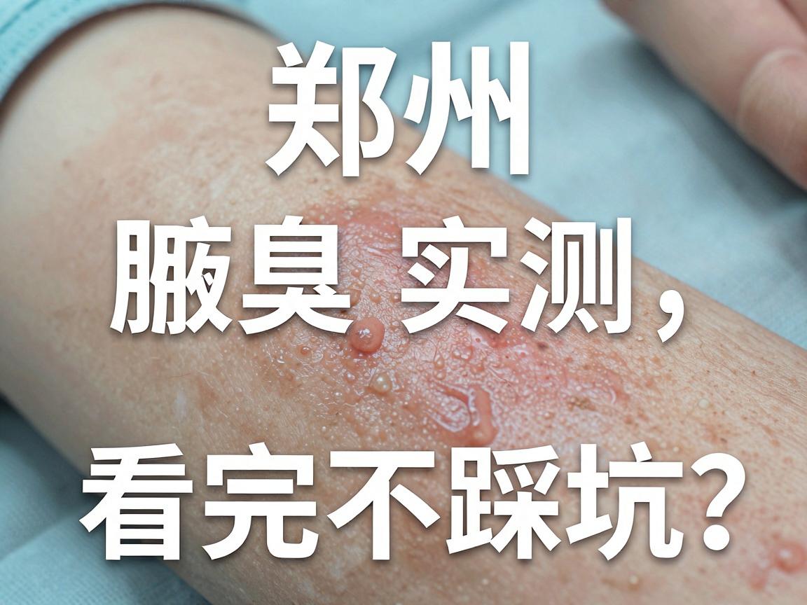 郑州腋臭手术医院怎么选？腋臭手术医院口碑实测，看完不踩坑