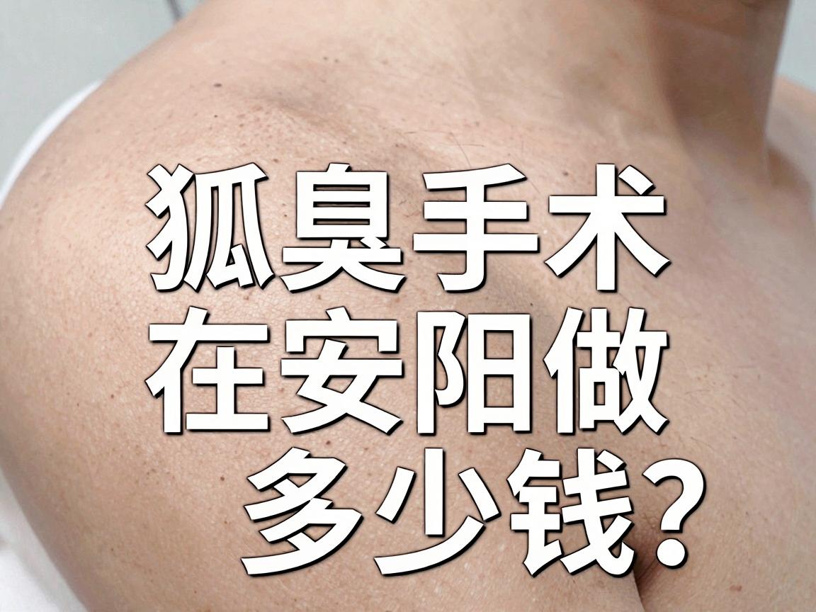 安阳狐臭手术价格大公开!狐臭手术在安阳做多少钱?这篇说透 安阳狐臭手术价格大公开!狐臭手术在安阳做多少钱?这篇说透