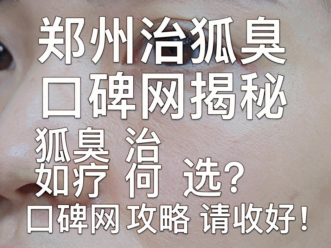 郑州治狐臭医院口碑网揭秘,狐臭治疗如何选?这份口碑网攻略请收好 郑州治狐臭医院口碑网揭秘,狐臭治疗如何选?这份口碑网攻略请收好