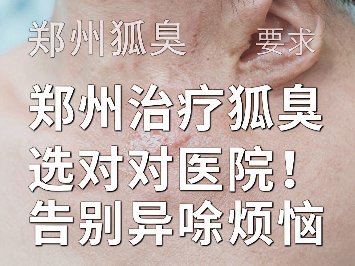 郑州治疗狐臭,选对医院,告别异味烦恼 郑州狐臭治疗医院专业解析 郑州治疗狐臭,选对医院,告别异味烦恼 郑州狐臭治疗医院专业解析