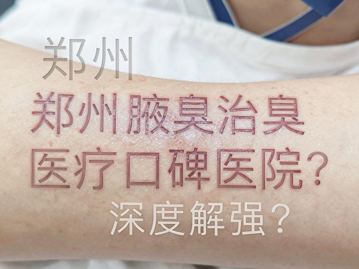 郑州治腋臭医院哪家强?郑州腋臭治疗口碑医院深度解析 郑州治腋臭医院哪家强?郑州腋臭治疗口碑医院深度解析