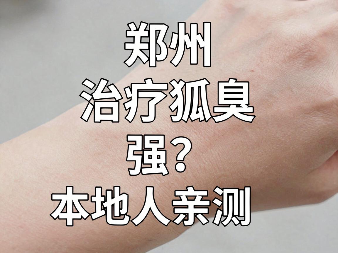 郑州治疗狐臭哪家医院强?本地人亲测,这家腋臭专科医院专治狐臭 郑州治疗狐臭哪家医院强?本地人亲测,这家腋臭专科医院专治狐臭