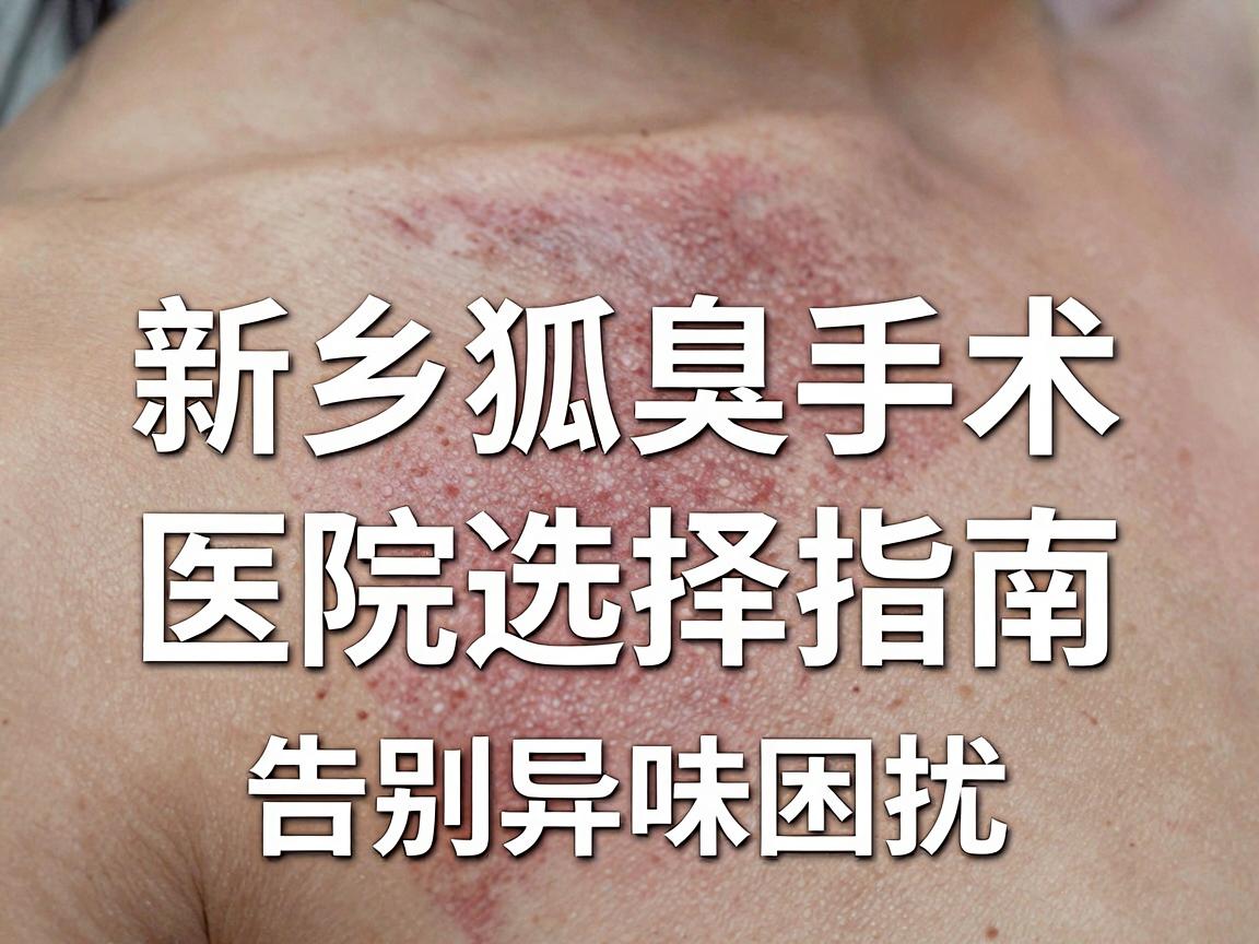 新乡狐臭手术哪里做?新乡狐臭手术医院选择指南,告别异味困扰 新乡狐臭手术哪里做?新乡狐臭手术医院选择指南,告别异味困扰