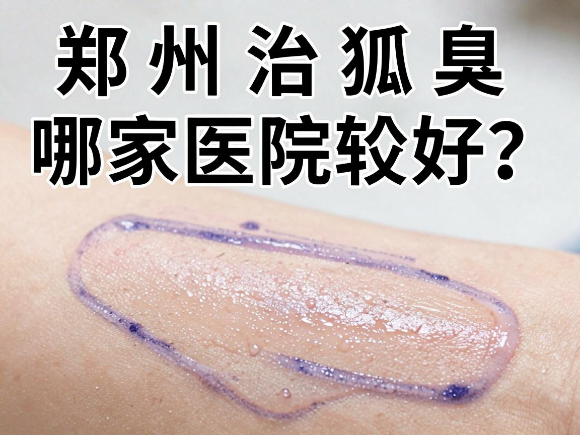 郑州治狐臭哪家医院较好?试试从这三方面对比选对郑州狐臭医院 郑州治狐臭哪家医院较好?试试从这三方面对比选对郑州狐臭医院