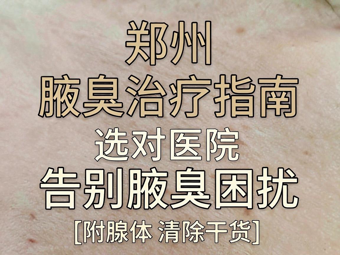 郑州腋臭治疗指南，选对医院，告别腋臭困扰（附腺体清除干货）