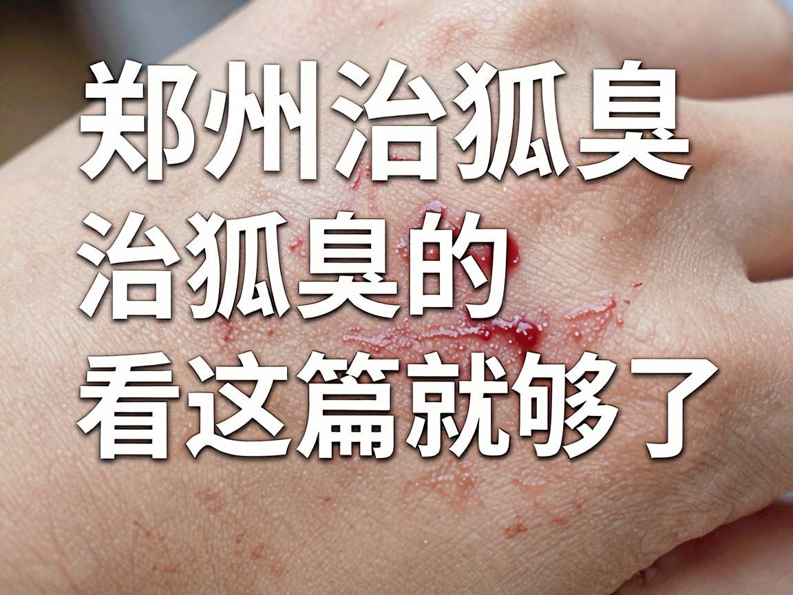郑州治狐臭医院怎么选?郑州专业治狐臭的医院看这篇就够了 郑州治狐臭医院怎么选?郑州专业治狐臭的医院看这篇就够了