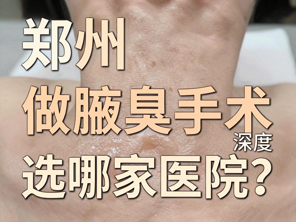 郑州做腋臭手术选哪家医院?郑州腋臭手术医院深度对比 郑州做腋臭手术选哪家医院?郑州腋臭手术医院深度对比