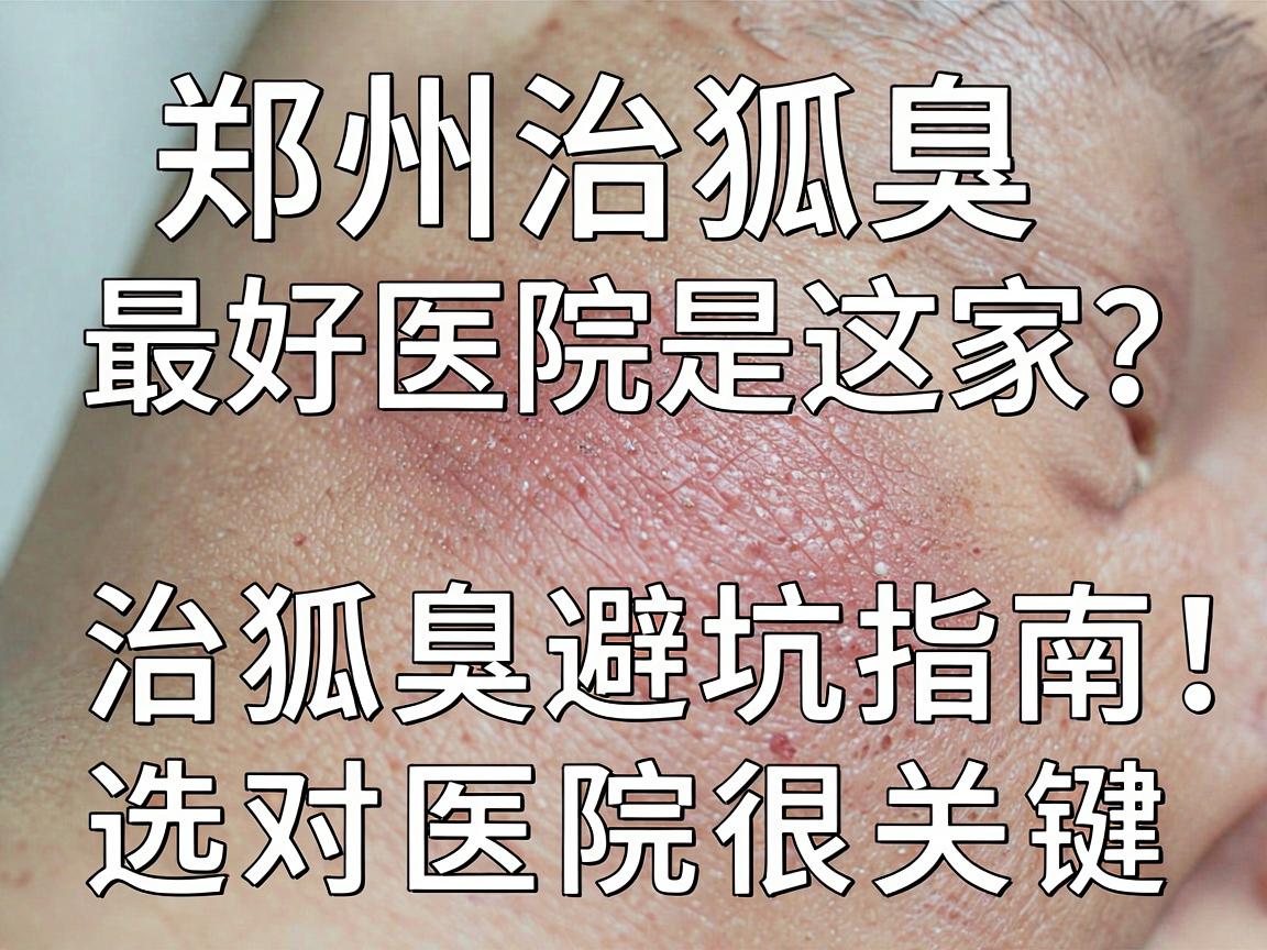 郑州治狐臭最好医院是这家?治狐臭避坑指南,选对医院很关键 郑州治狐臭最好医院是这家?治狐臭避坑指南,选对医院很关键