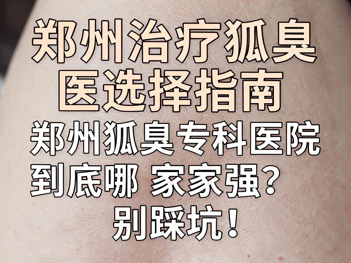 郑州治疗狐臭医院选择指南,郑州狐臭专科医院到底哪家强?别踩坑! 郑州治疗狐臭医院选择指南,郑州狐臭专科医院到底哪家强?别踩坑!
