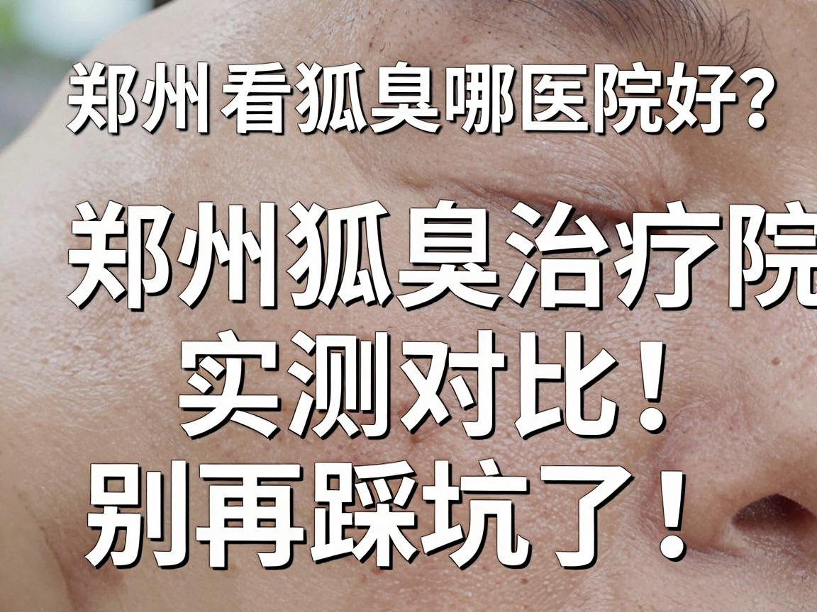 郑州看狐臭哪家医院好?郑州狐臭治疗医院实测对比,别再踩坑了! 郑州看狐臭哪家医院好?郑州狐臭治疗医院实测对比,别再踩坑了!