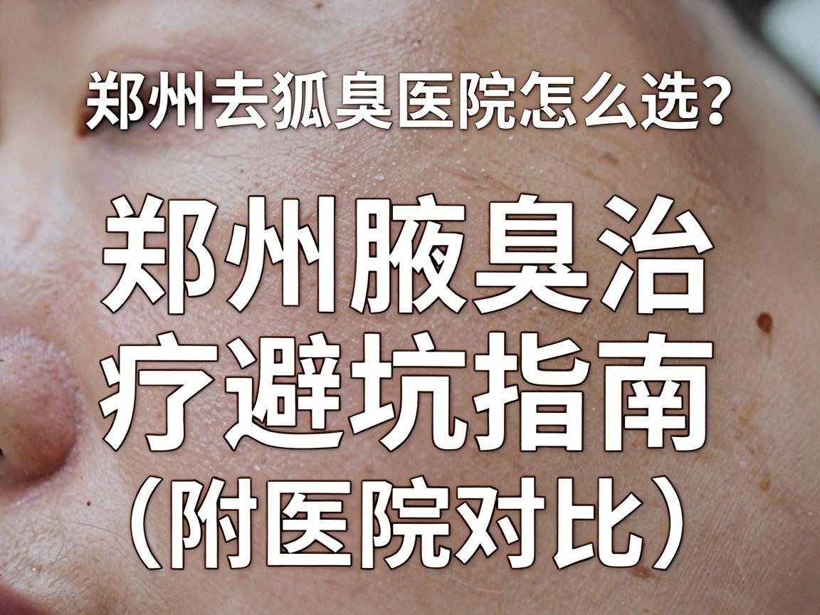 郑州去狐臭医院怎么选?郑州腋臭治疗避坑指南(附医院对比) 郑州去狐臭医院怎么选?郑州腋臭治疗避坑指南(附医院对比)