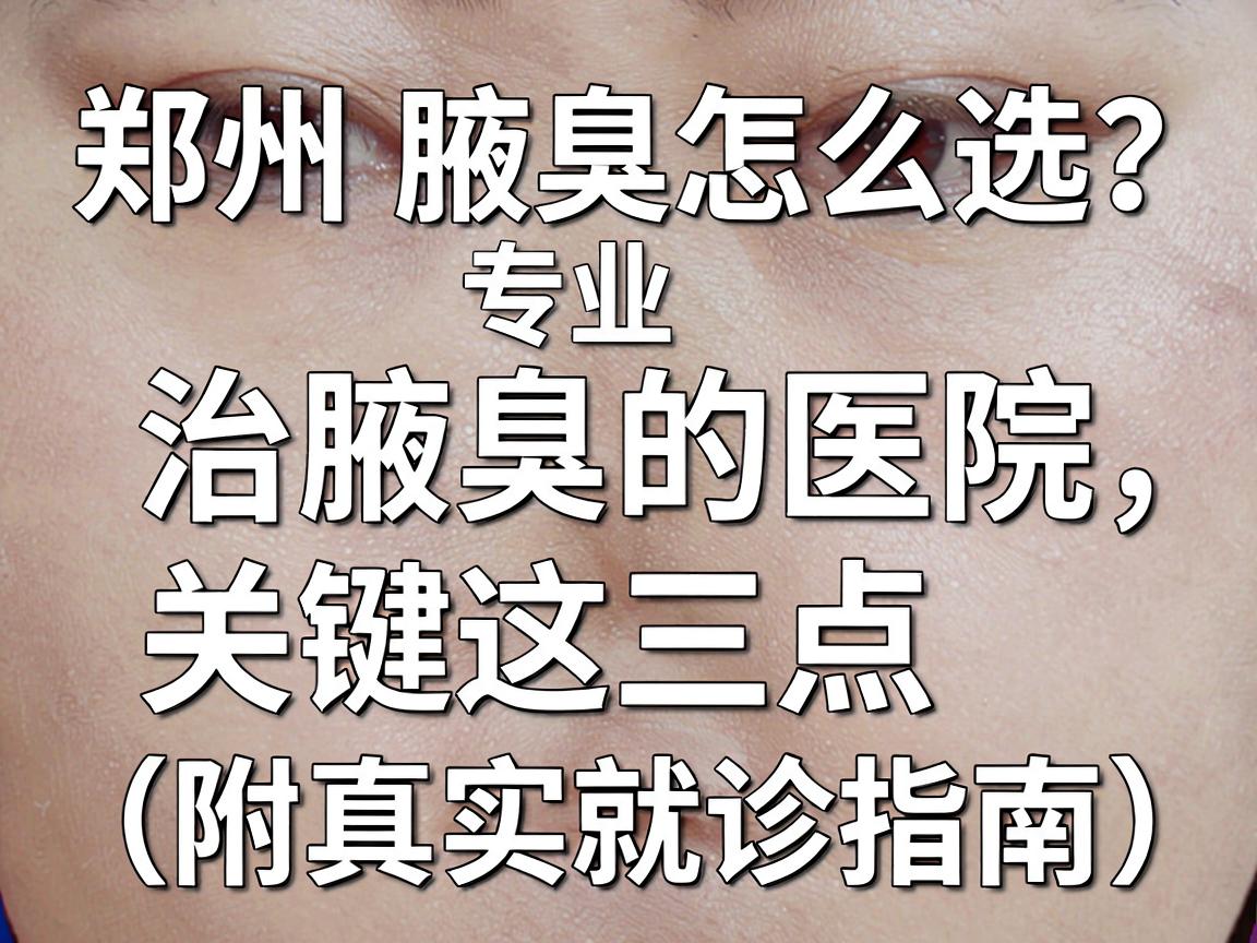 郑州腋臭医院怎么选？专业治腋臭的医院，关键看这三点（附真实就诊指南）