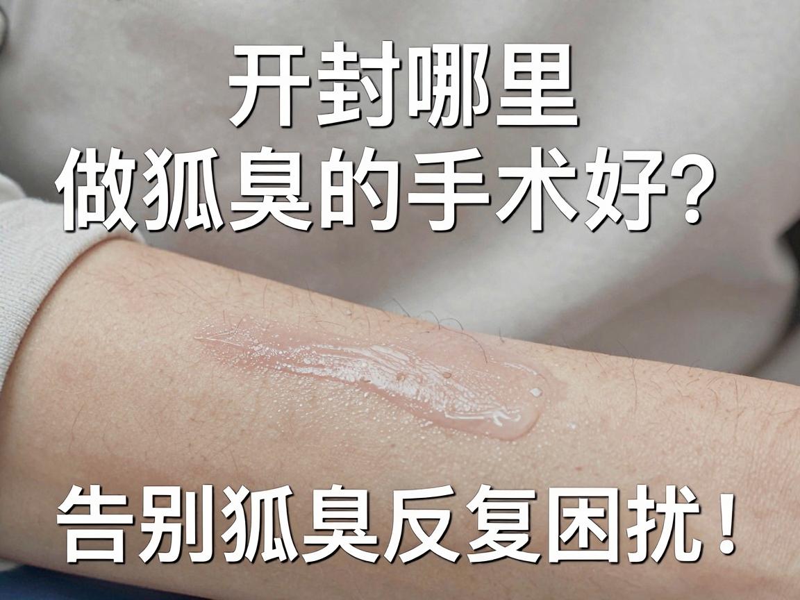 开封哪里做狐臭的手术好?选对技术,告别狐臭反复困扰! 开封哪里做狐臭的手术好?选对技术,告别狐臭反复困扰!