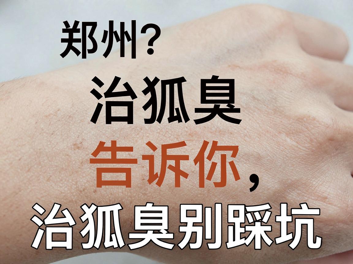治狐臭医院怎么选？郑州治狐臭医院排名告诉你，治狐臭别踩坑