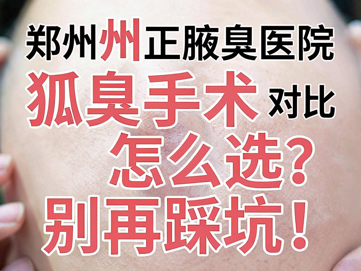 郑州狐臭手术怎么选？别再踩坑！郑州正规腋臭医院手术对比与避坑指南