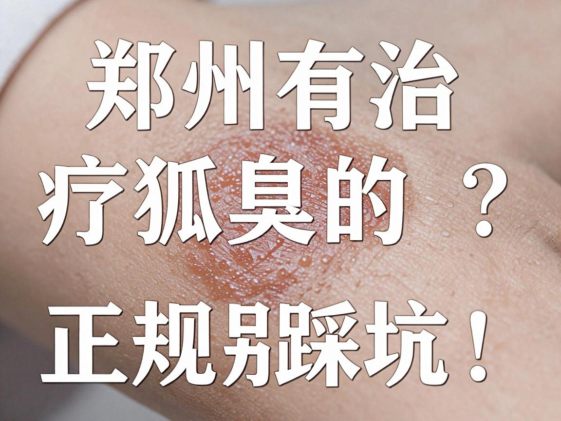 郑州有治疗狐臭的正规医院吗?正规医院治狐臭,别踩坑! 郑州有治疗狐臭的正规医院吗?正规医院治狐臭,别踩坑!