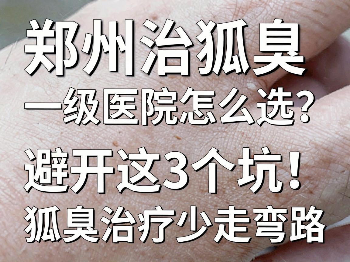 郑州治狐臭一级医院怎么选?避开这3个坑,狐臭治疗少走弯路 郑州治狐臭一级医院怎么选?避开这3个坑,狐臭治疗少走弯路