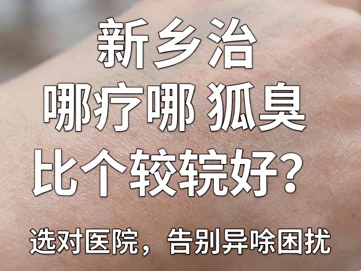 新乡治疗狐臭哪个医院比较好?选对医院,告别异味困扰 新乡治疗狐臭哪个医院比较好?选对医院,告别异味困扰